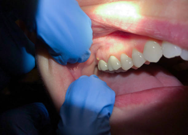 Best Emergency TMJ Treatment in Lawnside, NJ